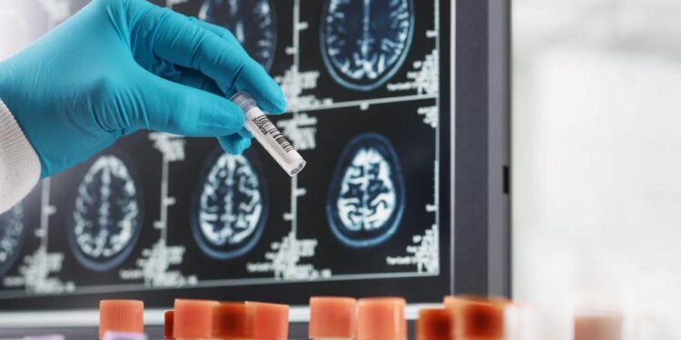 Latest Multiple Sclerosis Treatments Changing Lives in 2025: A Glimpse into the Future of MS Care